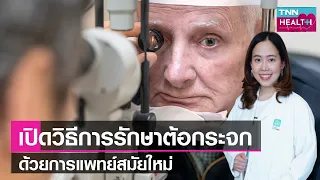 หากปล่อยต้อกระจกไว้โดยไม่รักษา จะเกิดภาวะแทรกซ้อนอะไรบ้าง