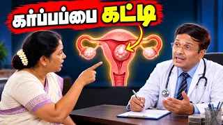 ஆபரேஷனுக்கு முன் இந்த 1 கேள்வி கேளுங்க | Fibroid Tamil Health | Dr Karthikeyan