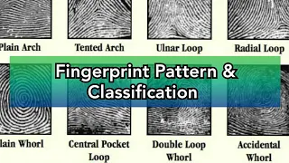Pattern and Categories of Fingerprints Criminalistics Dactyloscopy