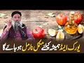 Download Lagu Uric Acid Ka Fori Ilaj | Uric Acid Ka Asan Ilaj | Uric Acid Treatment At Home | Dr SHarafat Ali