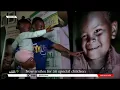 Operation Smile Eastern Cape Health team up for life-changing surgeries on children
