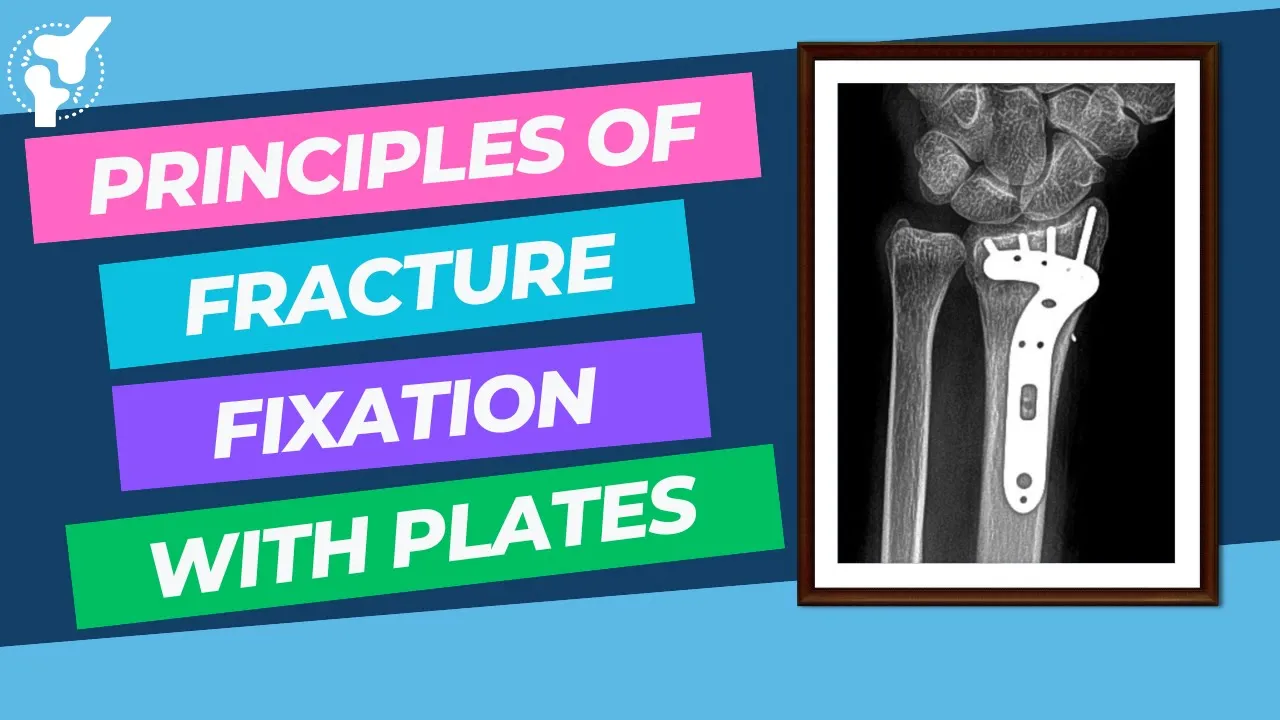 Principles of Fracture Internal Fixation With Plates and Screws | Material Properties
