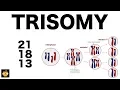 Trisomy 21 18 and 13 Nondisjunction Genetics