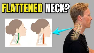 Straight Neck on X-Ray? What It Really Means (And the Best Exercises to Start With)