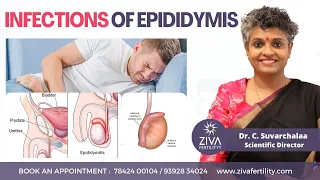 Infections Of Epididymis Male Infertility Dr C Suvarchalaa ZIVA Fertilityy