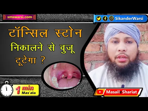 tonsil stone nikalwane se kya wuzu toot jata hai | muhn ki safai ki ahmiat | #OneMinuteMasail