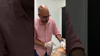 Butt Fillers