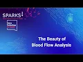 Sparks! | SciArt Work: The Beauty of Blood Flow Analysis | Fraunhofer Institute for Digital Medicine