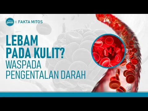 Awas! Pengentalan Darah Picu Penyakit Berbahaya, Ini Tandanya