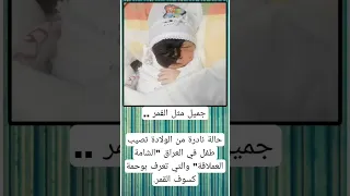 حالة نادرة دندنها