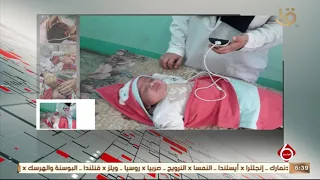نشرة السادسة   الصحة  توقيع الكشف المبكر وعلاج ضعف وفقدان السمع لمليون طفل دندنها