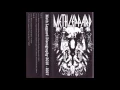 Download Lagu Meth Leppard - Discography 2015-2017 comp. FULL ALBUM (2017 - Grindcore)
