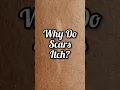 Why Do Scars Itch