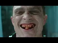 Bullseye Use His Tooth to Kill - Daredevil Born Again Episode 8