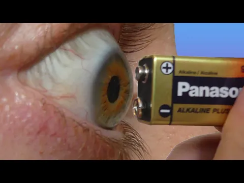 9V BATTERY IN MY EYE