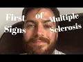 First Symptoms of Multiple Sclerosis 5 Early Signs of Multiple Sclerosis Life of Seb