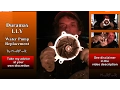 Duramax LLY 6 6L Water Pump Replacement