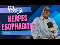 is it Strep Throat or Herpes Esophagitis Likely Strep
