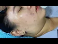 Massage Mat Relax With Hana Spa Clicnic Cham soc da mat cho khach