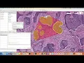 QuPath script - Create surrounding annotation
