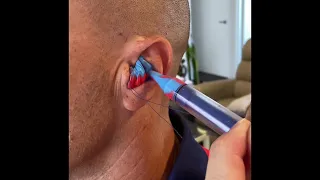 Semi-Permanent Ear Plug