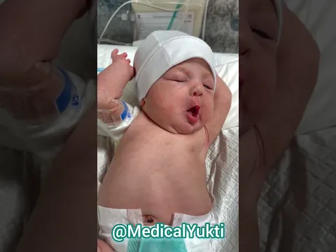 Be peaceful little life journey 🥰 #nclex_rn #nclex #care #nicu  #medicalyukti #shorts #nicucare