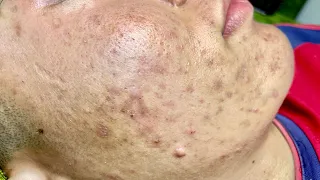 Satisfying video with Chung Vo Spa | 405