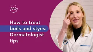 How to treat boils styes Dermatologist tips