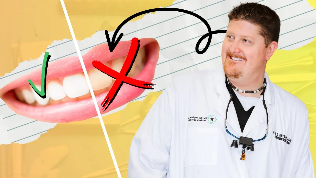Outline Video Don't Let Your Dental Veneers Turn Yellow: Tips to Keep Them Clean