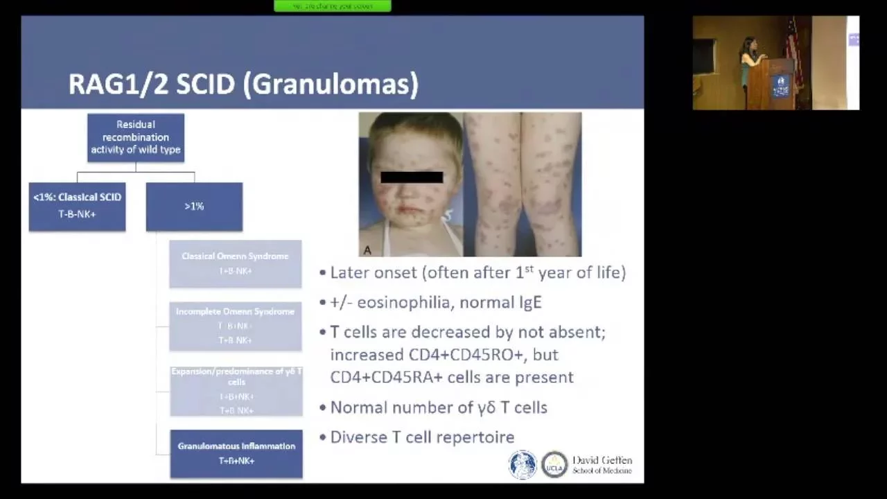 Recognizing SCID Phenotypes