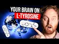 Your AD Brain On L-Tyrosine