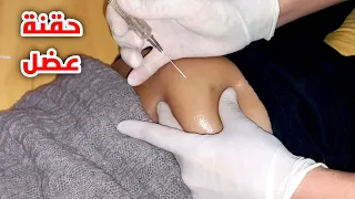 تعلم اعطاء الحقن العضل في المنزل او المستشفي تطبيق عملي Intramuscular Injection At Home 
