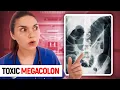 Day in the Life of a DOCTOR Hospital Vlog TOXIC MEGACOLON