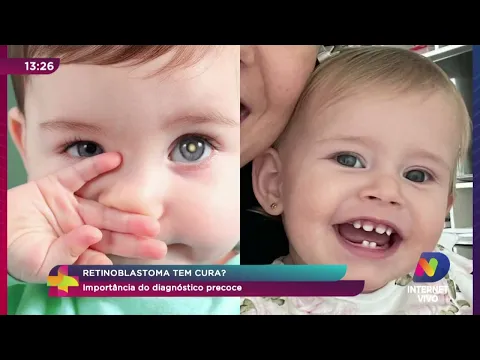 Oftalmologista pediatra alerta sobre tipo raro de câncer nos olhos