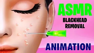 asmr blackhead removal animation