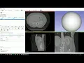 Basics 2 3D Slicer basic tools