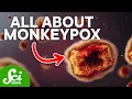 The Truth Behind Monkeypox