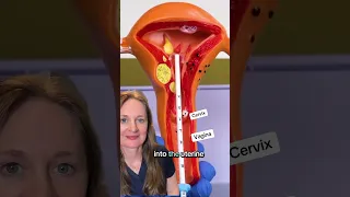 Did You Learn Something Iud 