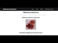 Melanoma Detection Using Convolutional Neural Network Python Final Year IEEE Project