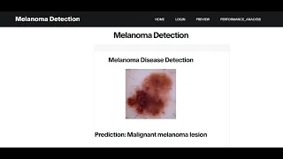 Melanoma Detection Using Convolutional Neural Network Python Final Year IEEE Project
