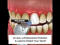 Download Lagu How to get Professional Teeth Cleaning at Sabka Dentist