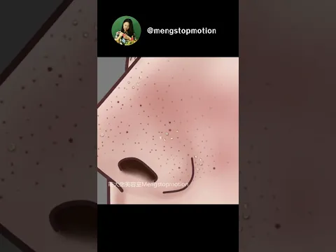 Oddly Satisfying ASMR Animation: Pimple Popping + Blackhead Removal ✨ Night Skincare Routine #asmr