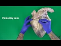 Download Lagu Anatomy of the Bovine Heart, Valves of the Heart