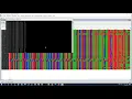 Multiple Sequence Alignment using BioEdit