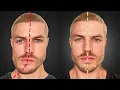 Download Lagu How to Fix Jaw \u0026 Face Asymmetry (FOREVER)