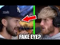 JEFF WITTEK SHOWS US HIS EYE INJURY