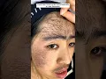 Download Lagu Remove Facial Hair Naturally At Home In 5min/Upper Lips \u0026 Unwanted Facial Hair Removal #shorts#viral