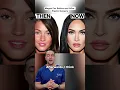 Plastic Surgeon Reveals Megan Fox s Transformation