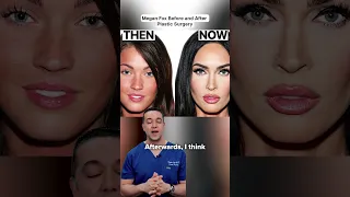 Plastic Surgeon Reveals Megan Fox s Transformation