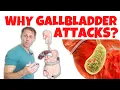 Understanding Gallbladder Attacks